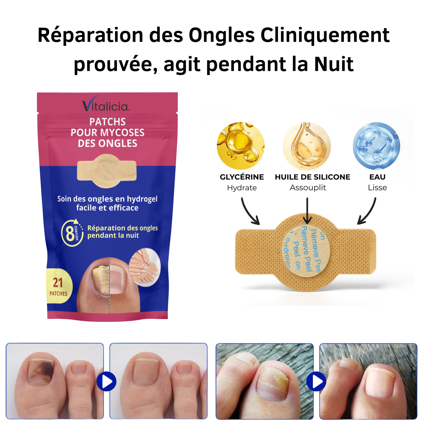 Vitalicia® Patch Régénération Mycose des Ongles