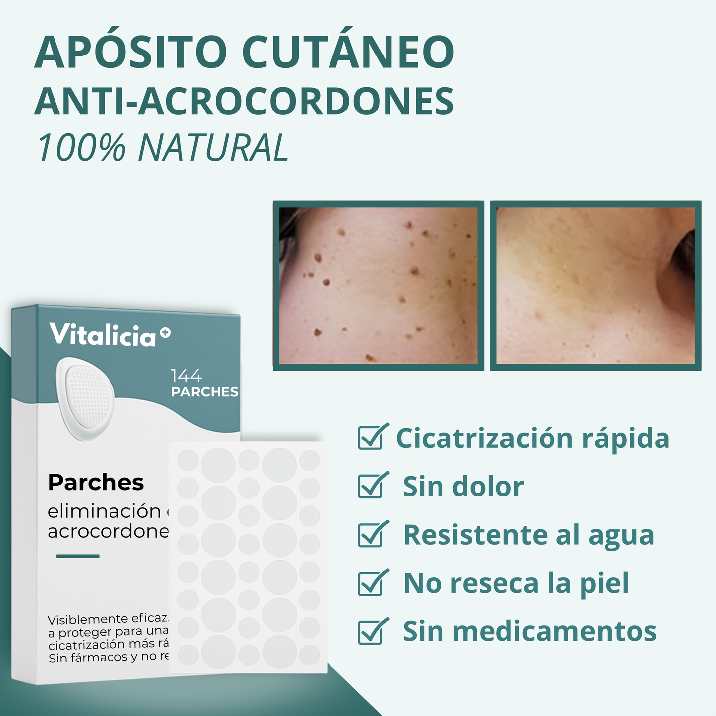 Vitalicia™ Parche Pro para Acrocordones + Gel de Aloe Vera