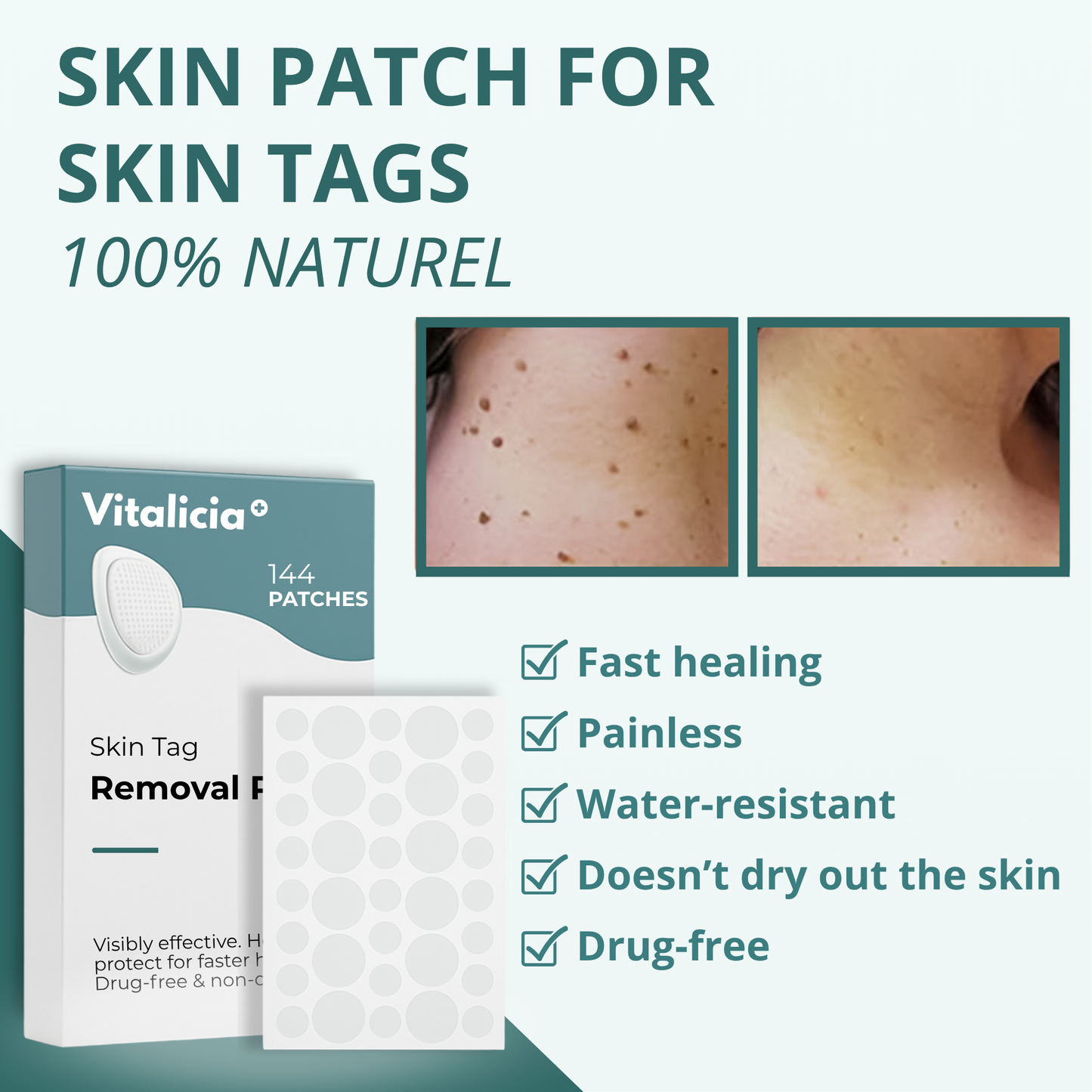 Vitalicia™ Pro Skin Tag Patch + Aloe Vera Gel